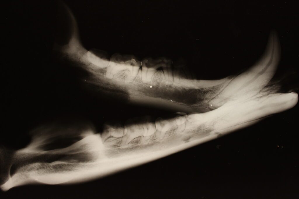 The x-ray of a black bear mandible with visible bits of lead in the bone. 