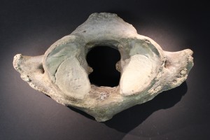 Anterior view.