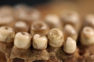 Teeth present in the specimen